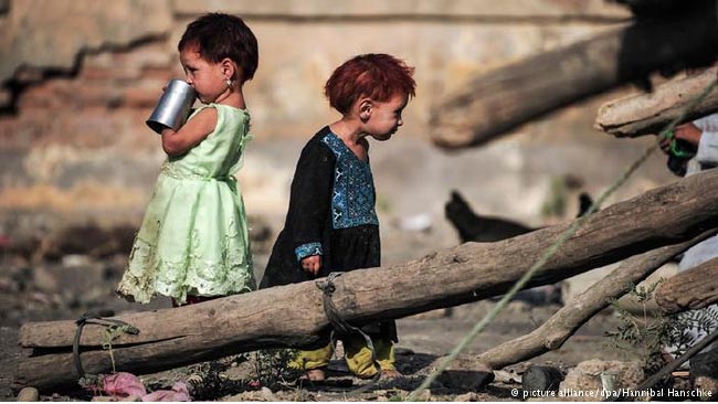 ملل متحد: یک میلیون کودک در افغانستان از سوء تغذیه رنج می برند